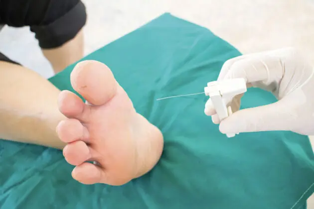 foot screening program
