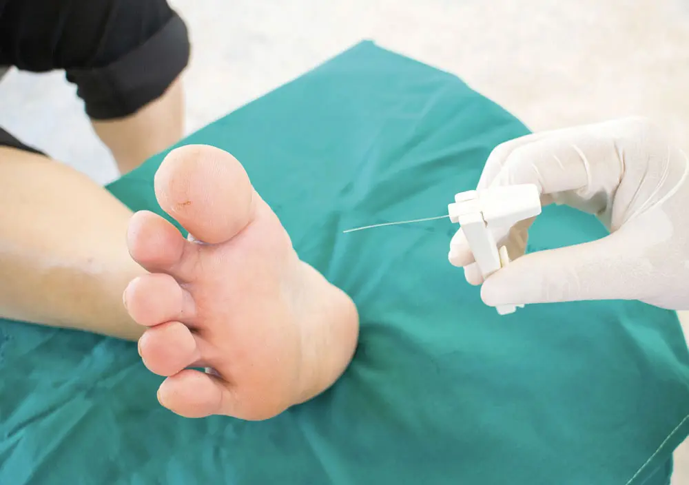 foot screening program